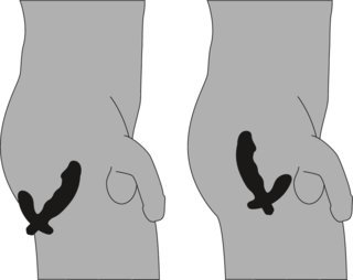Prostata-Vibrator in Penisform