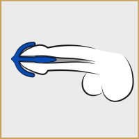 Vorschau: Penisplug Sperm Anker