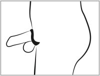 Vorschau: Penis Käfig mit Dilator