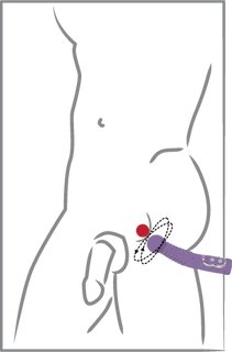 prostate-twister-zum-prostata-melken-massage-vibrator-maenner-05844440000-_1XAeNi0C7fXYWv