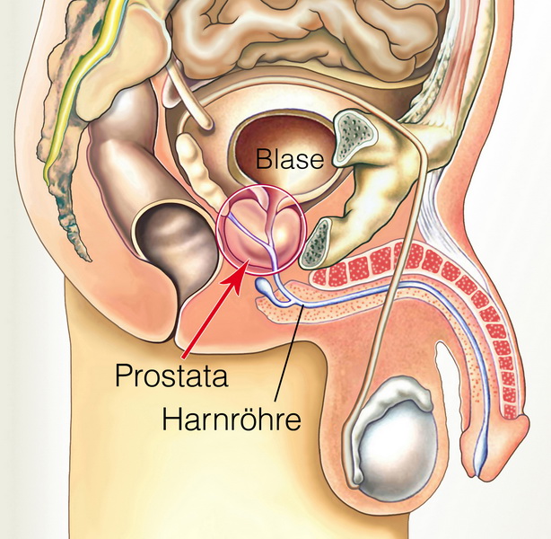 Prostata-Massage-Zeichnung