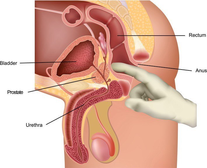 Prostata-Massage-zwangsentsamung